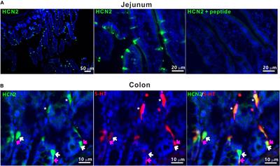 Oral Administration of Penicillin or Streptomycin May Alter Serum Serotonin Level and Intestinal Motility via Different Mechanisms